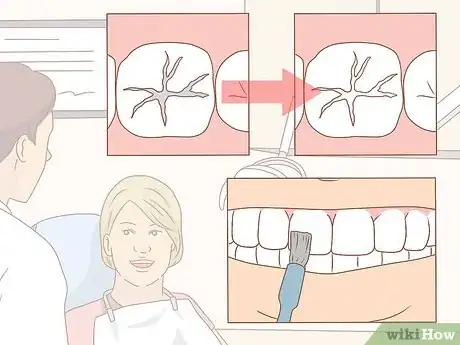 Image titled Take Good Care of Your Teeth Step 14