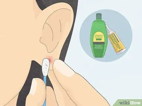 Image titled Clean Your Ear Piercing Step 10
