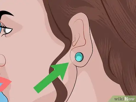 Image titled Reopen a Partially Closed Ear Piercing Hole Step 17