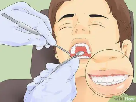 Image titled Get Rid of White Spots on Teeth Step 7