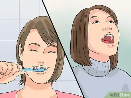 Image titled Prepare on the Day You Get Braces Step 15