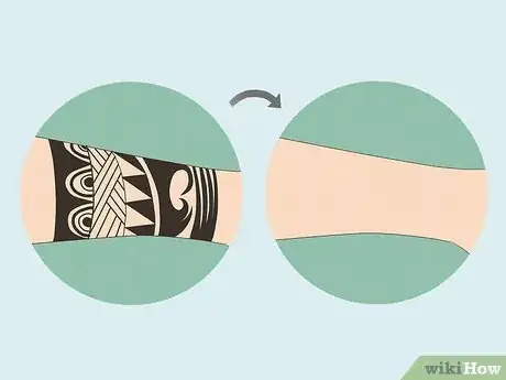 Image titled Stop Tattoo Itching Step 14