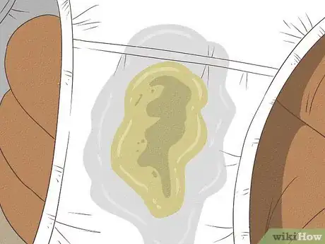 Image titled Get Rid of Vaginal Odor Fast Step 11