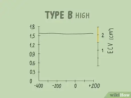 Image titled Read a Tympanogram Step 10