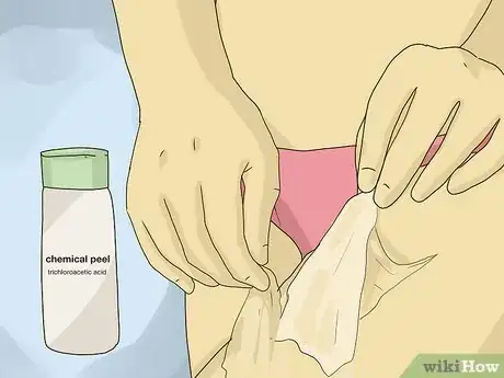 Image titled Get Rid of Stretch Marks Step 5