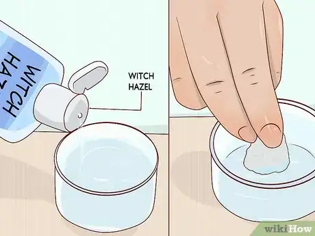 Image titled Use Witch Hazel to Reduce Hemorrhoids Step 3