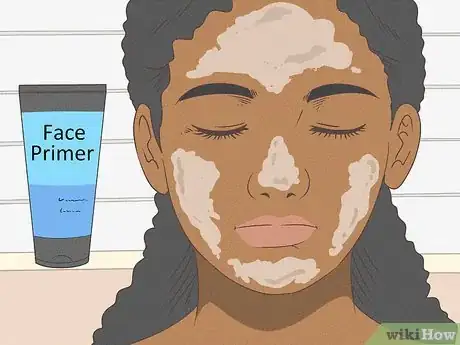 Image titled Get Rid of Spots on Your Skin Step 7