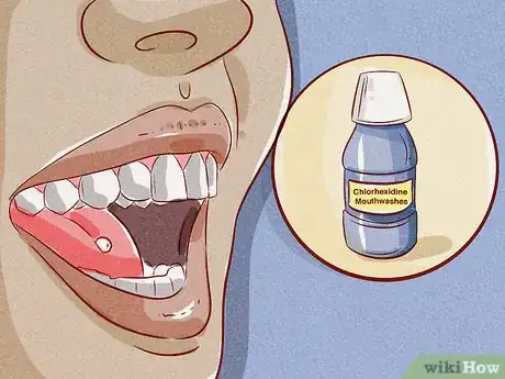 Image titled Brush Your Teeth with a Tongue Piercing Step 8