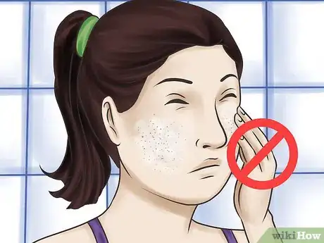 Image titled Use Aloe Vera for Acne Step 11