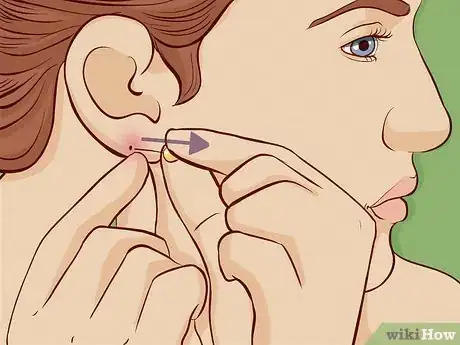 Image titled Close an Earlobe Piercing Step 1