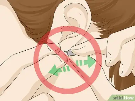 Image titled Keep a Piercing from Rejecting Step 4.jpeg