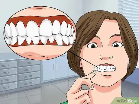 Image titled Strengthen Teeth and Gums Step 12