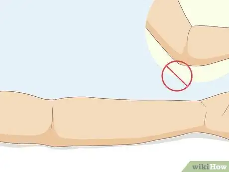 Image titled Troubleshoot a Difficult Venipuncture Step 9