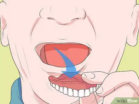 Image titled Apply Denture Adhesive Step 11