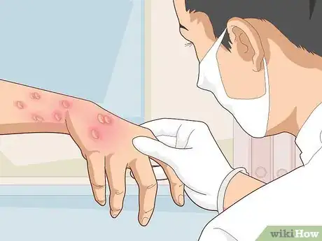 Image titled Get Rid of Poison Oak Rash Step 12