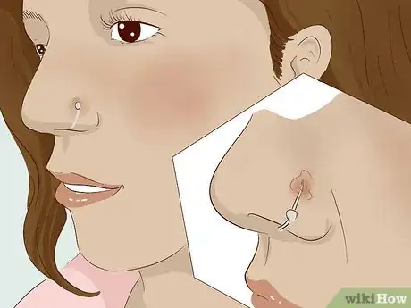 Image titled Keep a Piercing from Rejecting Step 9.jpeg
