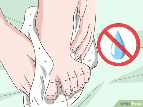 Image titled Stop Your Feet from Sweating Step 2