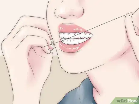 Image titled Remove Yellow Between the Teeth Step 2