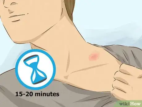 Image titled Hide a Hickey Step 9