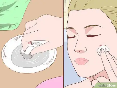 Image titled Stop a Zit from Bleeding Step 1