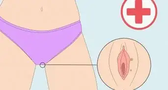 Stop Vaginal Itching