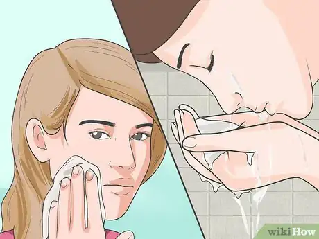 Image titled Get Rid of Acne on Your Nose Step 21