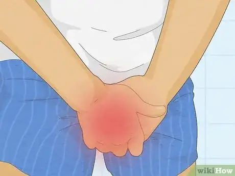 Image titled Recognize Chlamydia Symptoms (for Men) Step 2