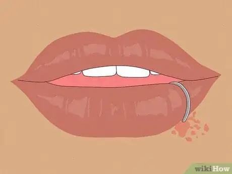 Image titled Take Care of a Lip Piercing Step 4