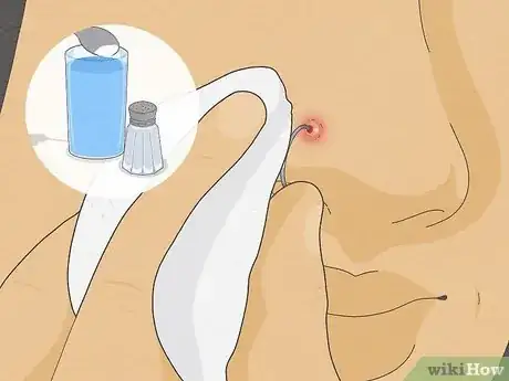 Image titled Treat an Infected Nose Piercing Step 1