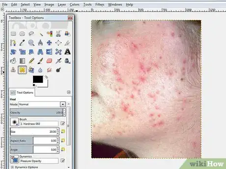 Image titled Remove Facial Blemishes on GIMP Step 1