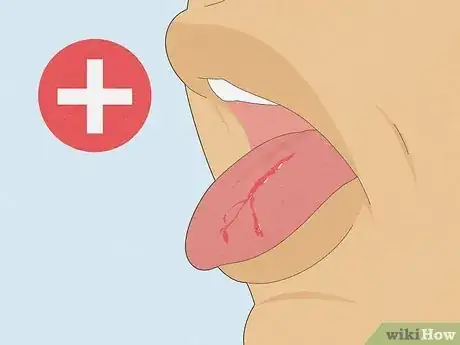 Image titled Heal a Cut on Your Tongue Step 11