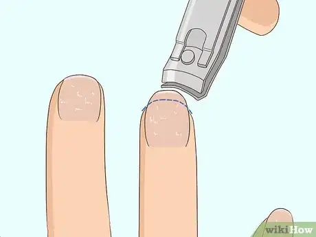 Image titled Stop Your Nails from Peeling Step 2