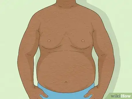 Image titled Detect Gynecomastia Step 3