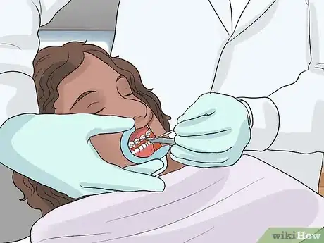 Image titled Prepare on the Day You Get Braces Step 11