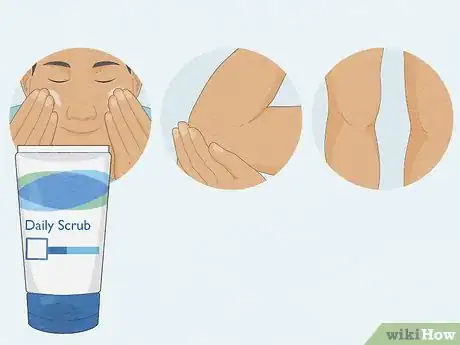 Image titled Care for Your Skin As a Guy Step 3