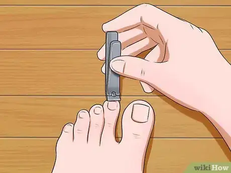 Image titled Prevent Nail Fungus Step 2