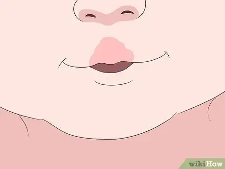 Image titled Remove Birthmarks Step 15