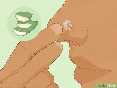 Image titled Treat an Infected Nose Piercing Step 5