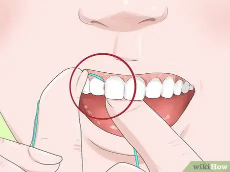 Image titled Know if Your Dental Fillings Need Replacing Step 6