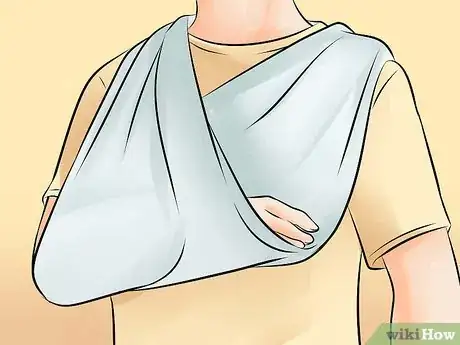 Image titled Apply Shoulder Injury Compression Wraps Step 16