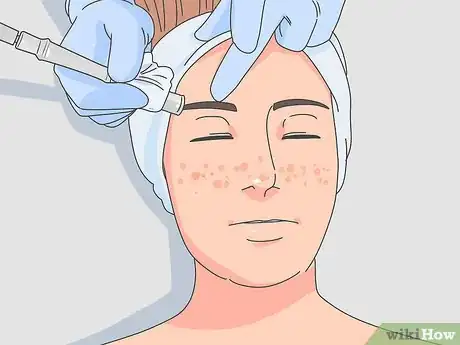 Image titled Get Rid of Dark Spots Step 12