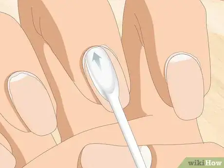 Image titled Heal Cuticles Step 5