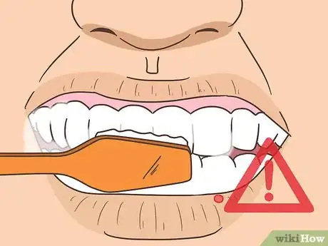 Image titled Remove a Mouth Ulcer Step 11