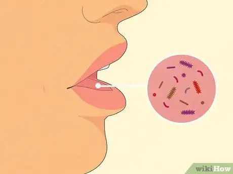 Image titled Recognize Chlamydia Symptoms (for Women) Step 7