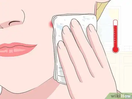 Image titled Stop a Pimple from Forming Step 2