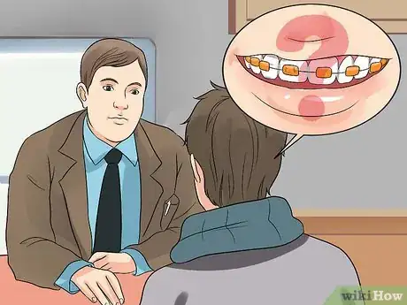 Image titled Prepare on the Day You Get Braces Step 10