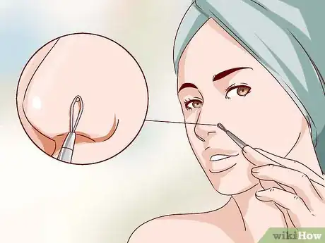 Image titled Buy a Blackhead Remover Step 8