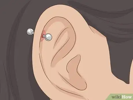 Image titled Treat an Ear Piercing Infection Bump Step 1