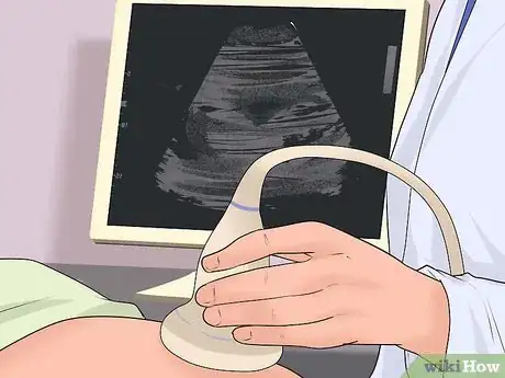 Image titled Deal with Placenta Previa Step 12