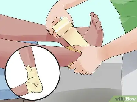 Image titled Tape an Ankle Like an Athletic Trainer Step 6